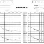 Audiogram A5 karta