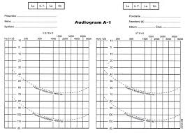 Audiogram A5 karta